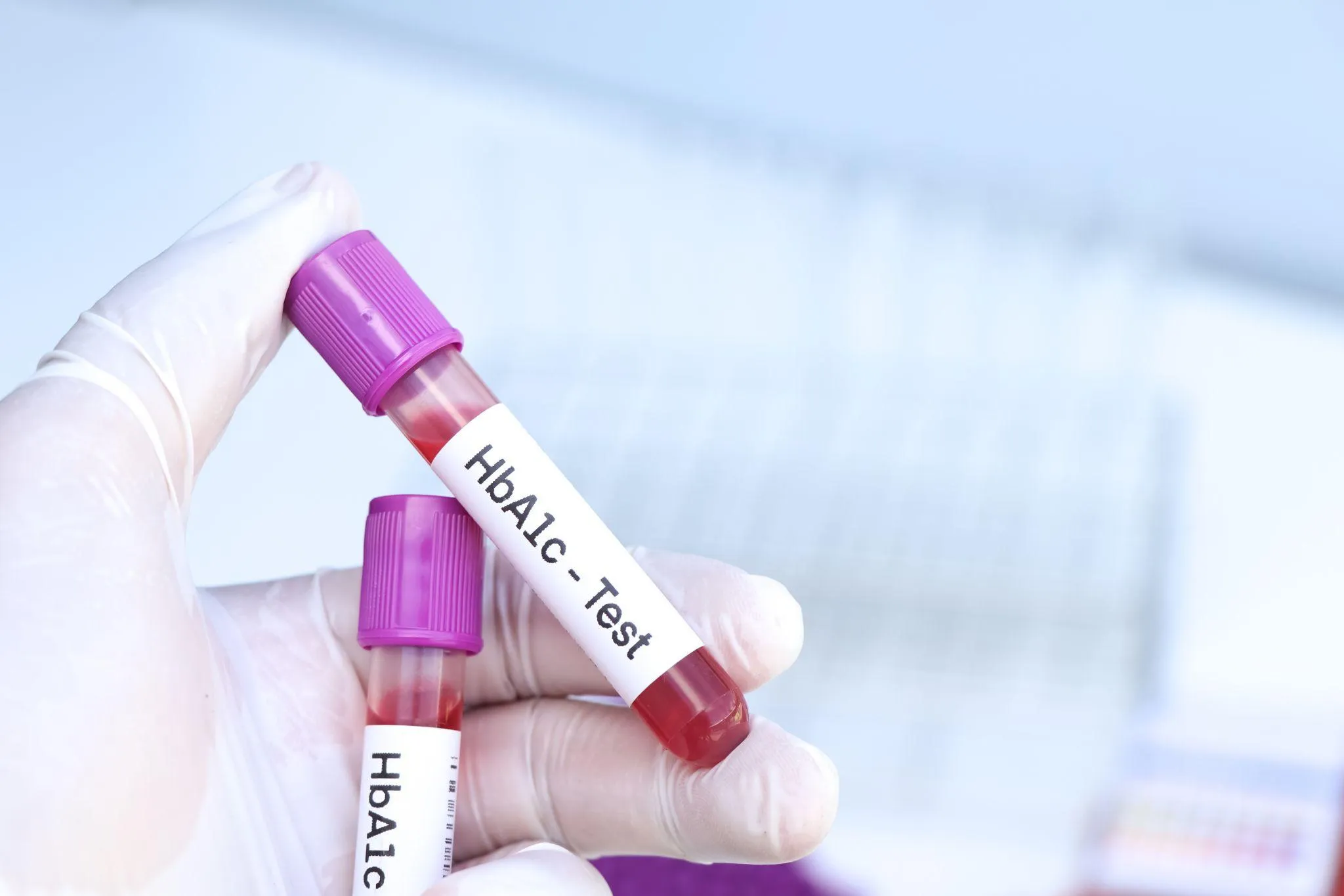 糖尿病の診断に使われる主な数値と基準値