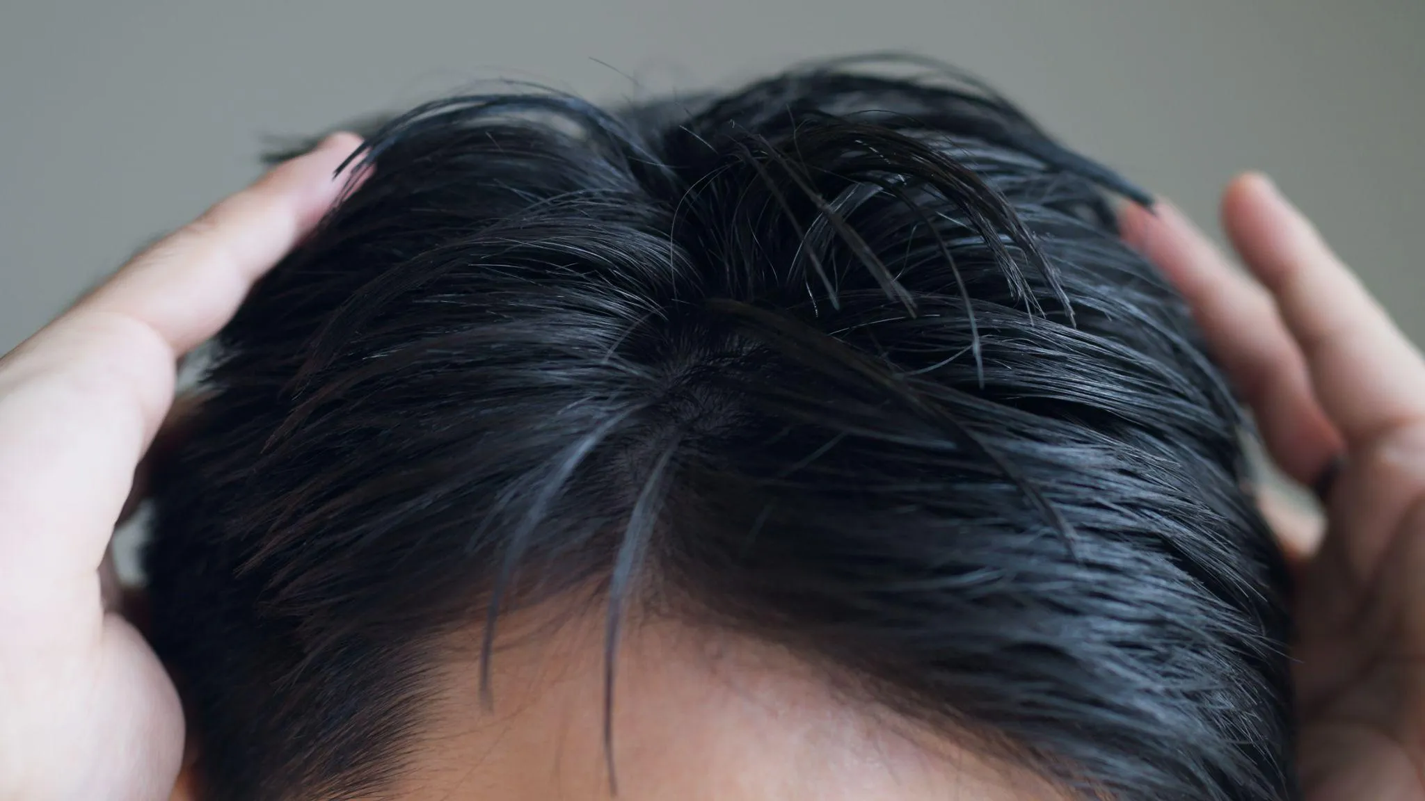 AGA治療の効果を実感している人の共通点