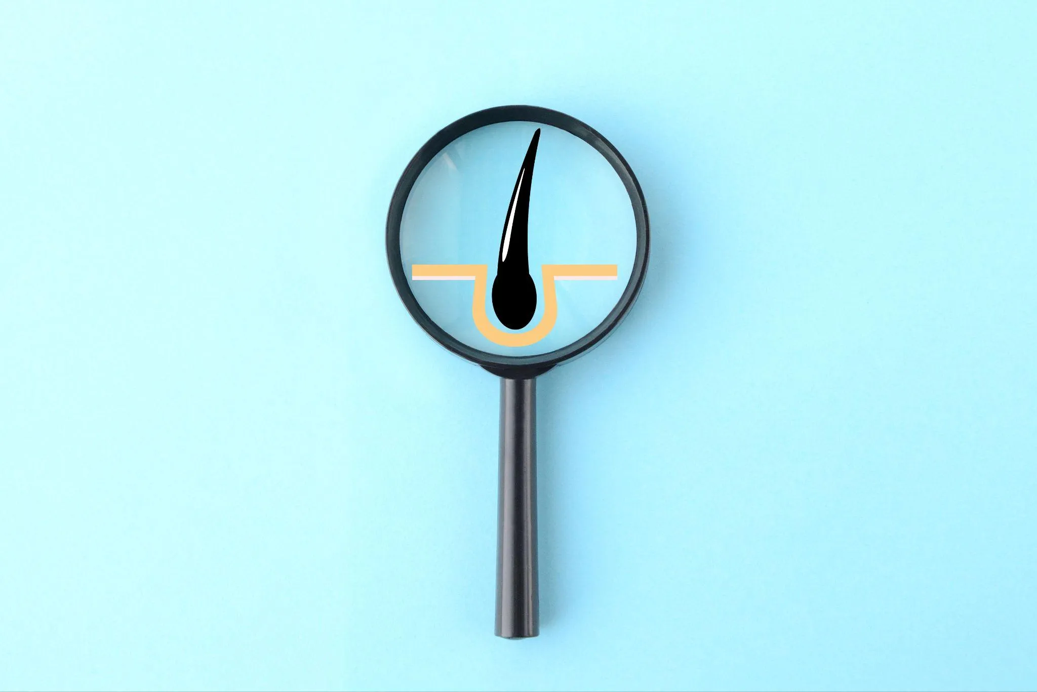 AGA治療における初期脱毛について